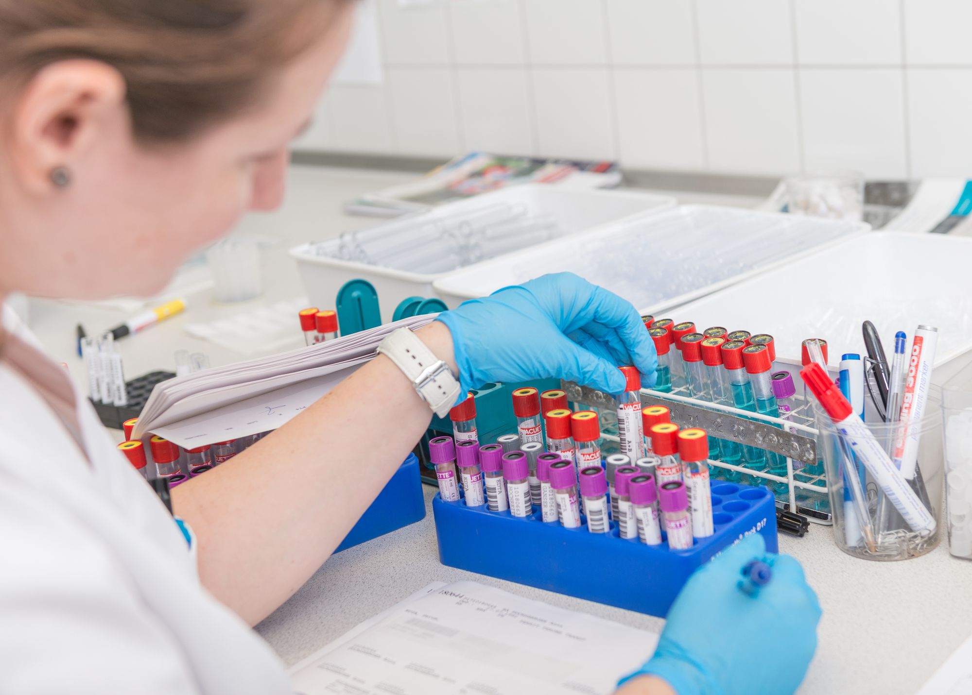 Probenvorbereitung im Labor