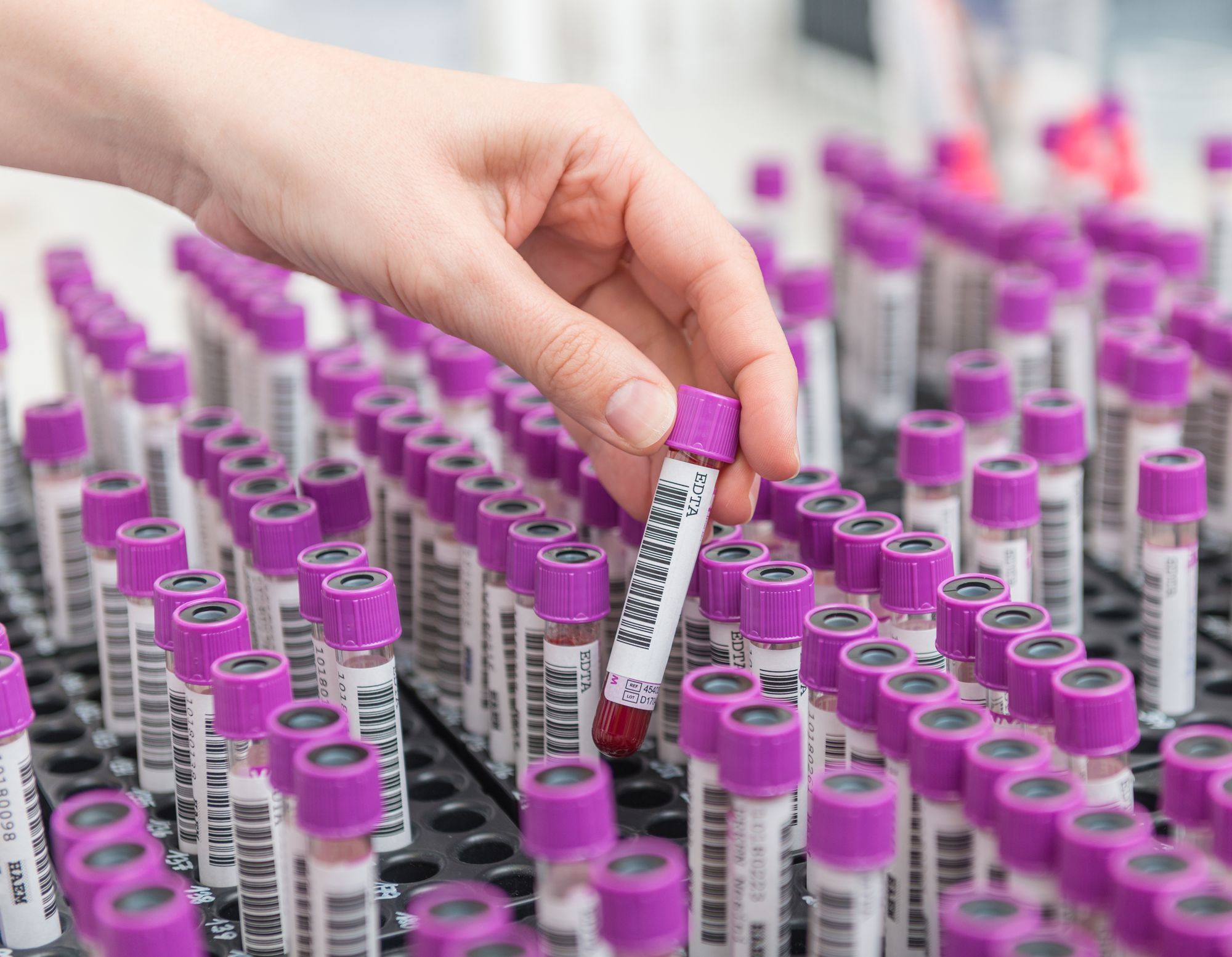 Probenröhrchen werden im Labor sortiert